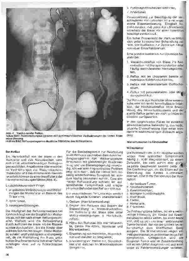 Vorschauseite 3: Urologie 11. Folge: Urologie im Kindesalter (II) Mißbildungen der Niere