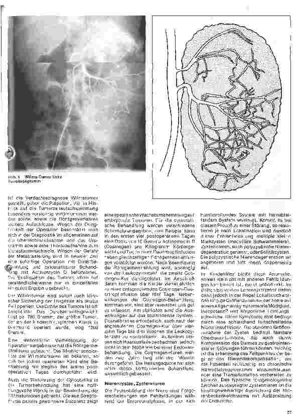 Vorschauseite 4: Urologie 11. Folge: Urologie im Kindesalter (II) Mißbildungen der Niere