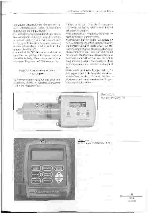 Vorschauseite 2: PATIENTINNEN-KONTROLLIERTE ANALGESIE (PCA): SCHMERZBELASTUNG HALBIERT