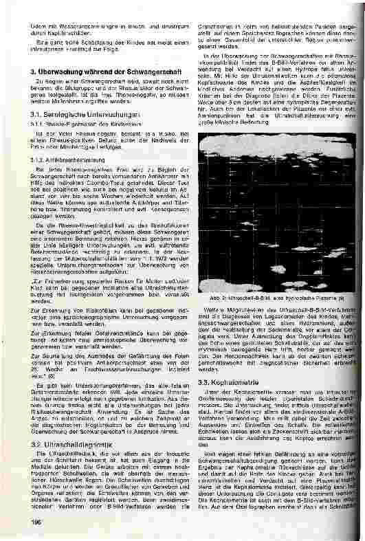 Vorschauseite 2: Die Rhesus-Inkompatibilität als Risikofaktor Überwachungsund Therapiemöglichkeiten