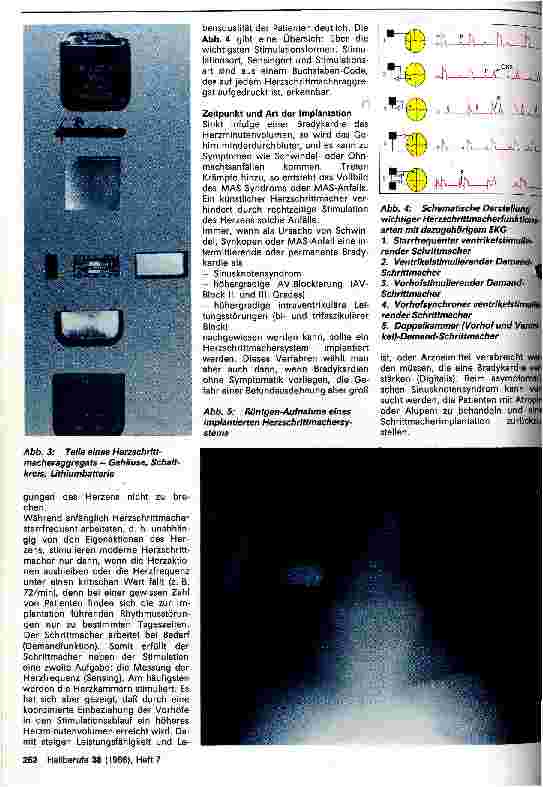 Vorschauseite 2: Der künstliche Herzschrittmacher