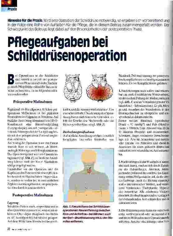 Vorschauseite 1: Pflegeaufgaben bei Schilddrüsenoperation