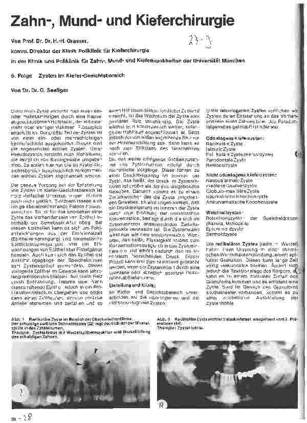 Vorschauseite 1: Zahn-Mundund Kieferchirurgie 6. Folge: Zysten im Kiefer-Gesichtsbereich