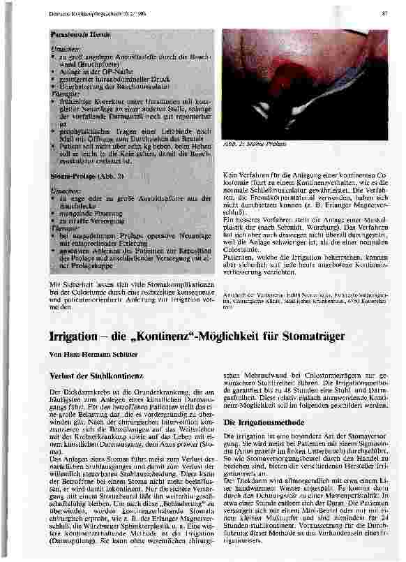 Vorschauseite 1: Die Versorgung eines künstlichen Darmausganges Irrigation - die Kontinenz-Möglichkeit für Stomaträger