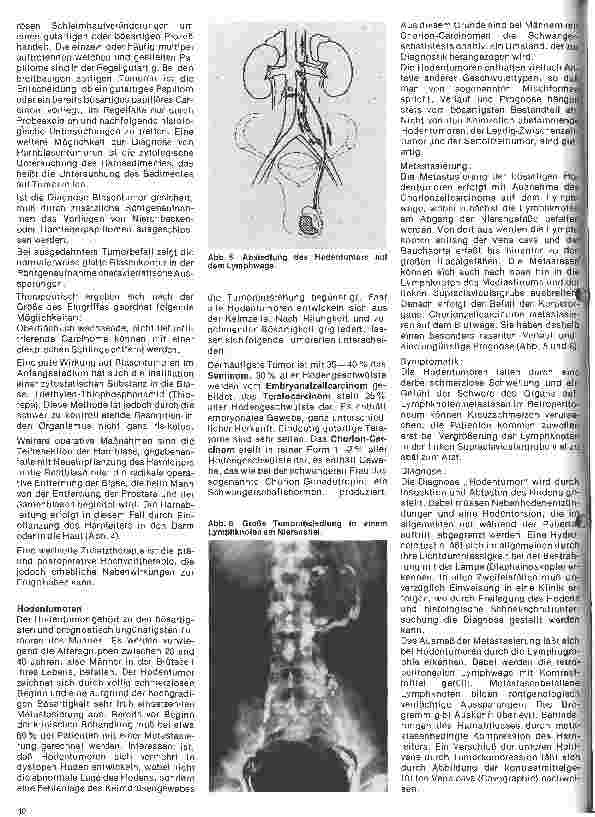 Vorschauseite 3: Urologie 7. Folge: Tumoren des Urogenitalsystems