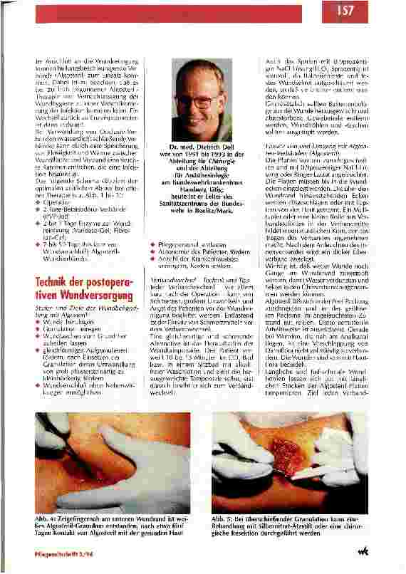 Vorschauseite 2: Verbände können die Wundheilung beschleunigen Alginate in der septischen Chirurgie