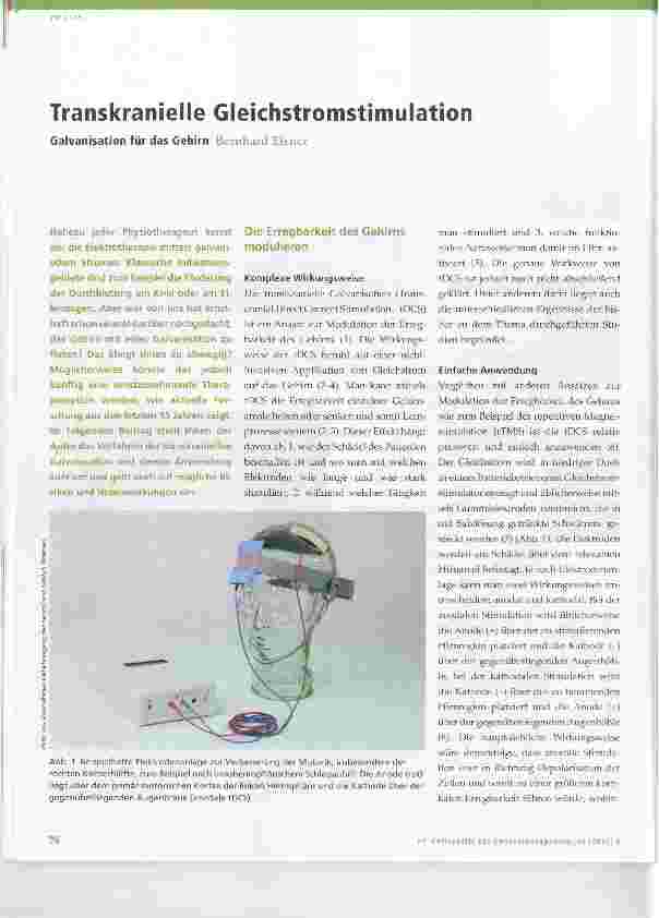Vorschauseite 1: Transkranielle Gleichstromstimulation