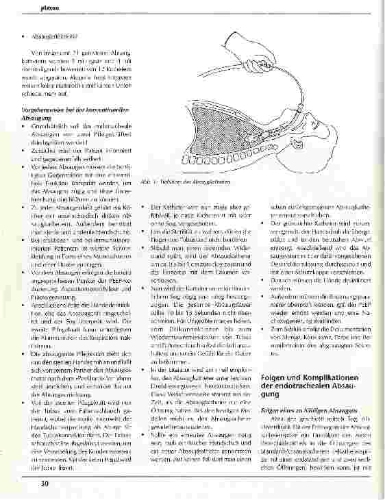 Vorschauseite 5: Das endotracheale Absaugen Geschlossene endotracheale Absaugung - ein Standard für die Zukunft?