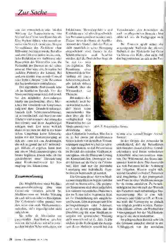 Vorschauseite 5: Die Alternative Möglichkeiten und Grenzen der Anwendung von Suppositorien über eine Colostomie