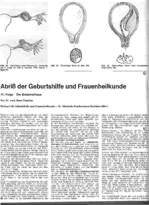 Vorschauseite 1: Abriß der Geburtshilfe und Frauenheilkunde 11. Folge: Die Endometriose