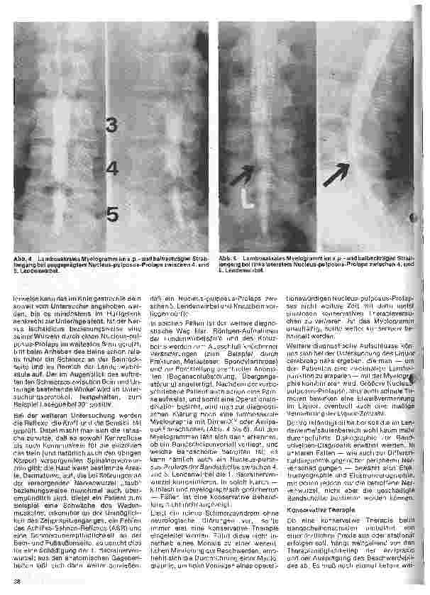 Vorschauseite 3: Themen aus der Neurochirurgie 4. Folge: Lumbale Bandscheibenvorfälle