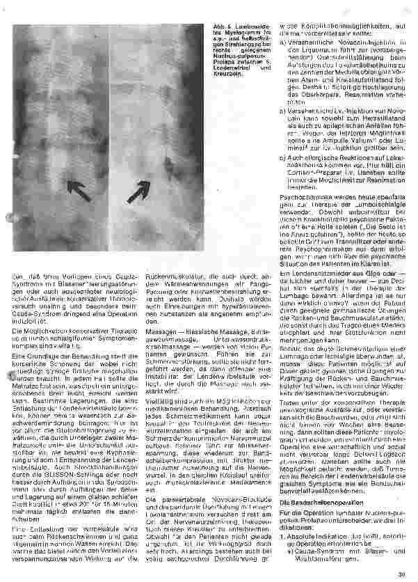 Vorschauseite 4: Themen aus der Neurochirurgie 4. Folge: Lumbale Bandscheibenvorfälle