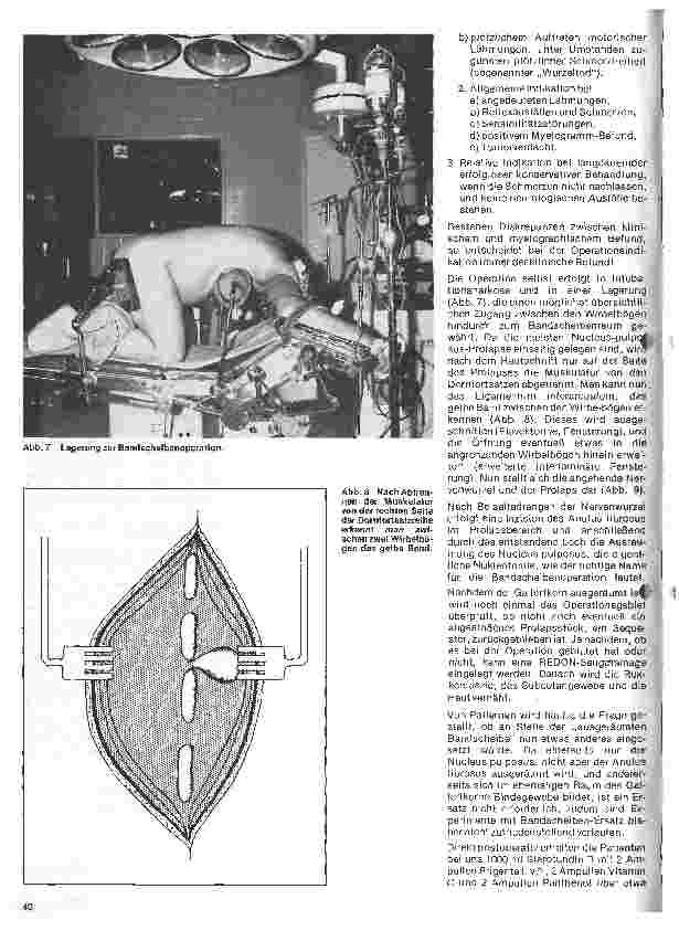 Vorschauseite 5: Themen aus der Neurochirurgie 4. Folge: Lumbale Bandscheibenvorfälle