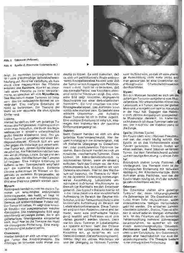 Vorschauseite 3: Zahn-Mundund Kieferchirurgie 10. Folge: Tumoren (I, gutartig)