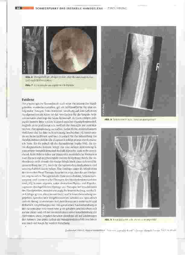 Vorschauseite 6: Karpale Instabilitäten Anatomie, Biomechanik und Pathologie