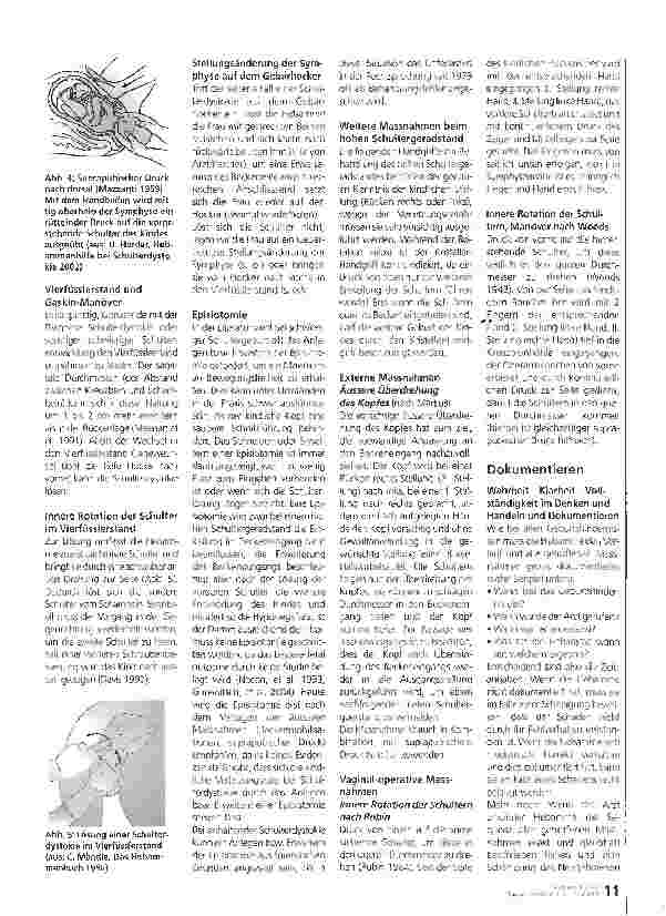 Vorschauseite 2: Vorgehen bei Schulterdystokie