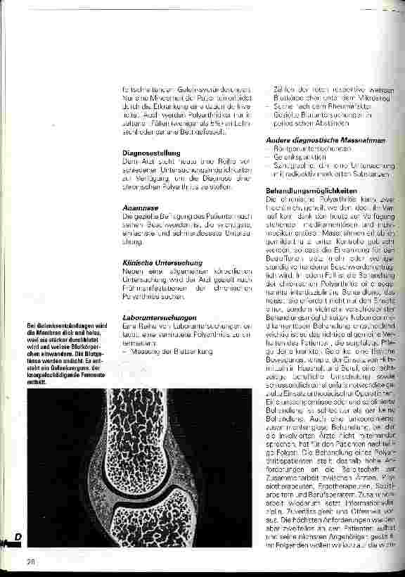 Vorschauseite 3: Ein Leben mit dem Schmerz Die chronische Polyathritis