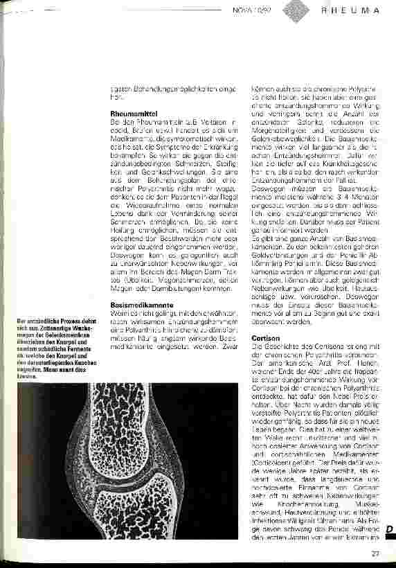 Vorschauseite 4: Ein Leben mit dem Schmerz Die chronische Polyathritis