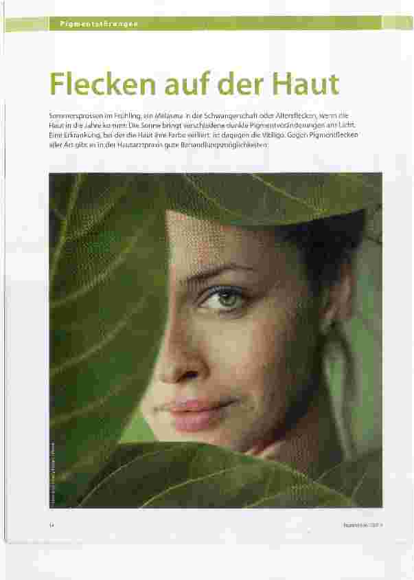 Vorschauseite 1: Flecken auf der Haut