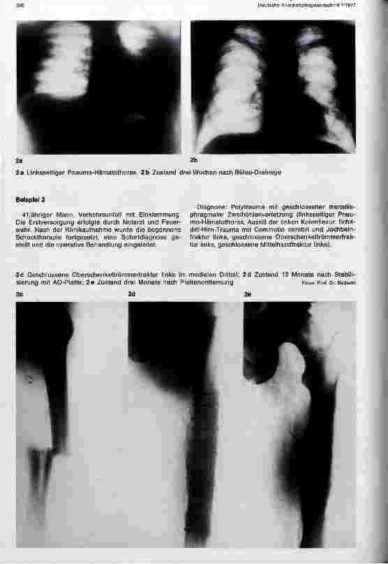 Vorschauseite 5: Rehabilitation unfallchirurgischer Patienten