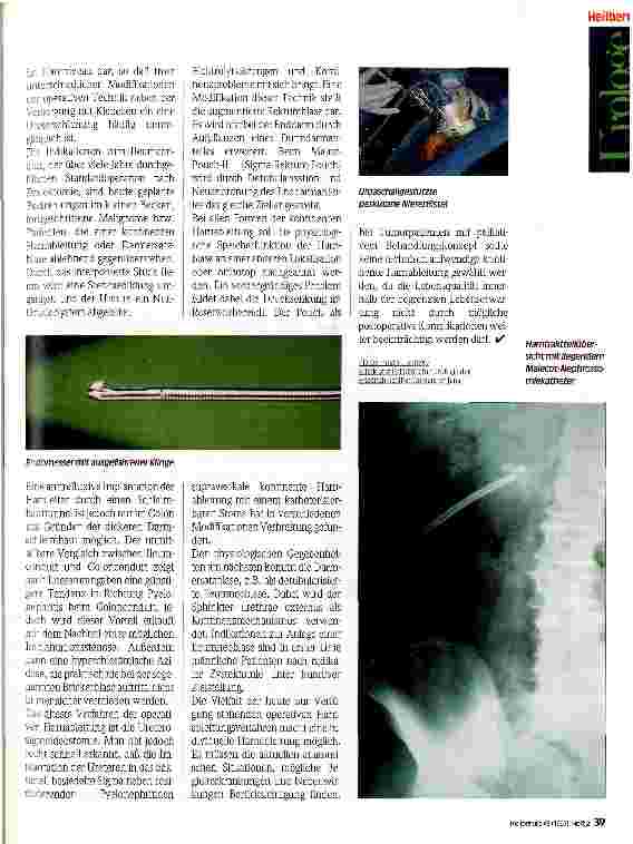 Vorschauseite 2: Harnableitung bei Tumorkranken