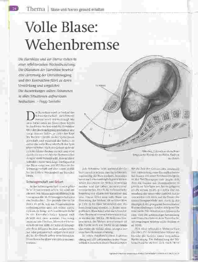 Vorschauseite 1: Volle Blase: Wehenbremse