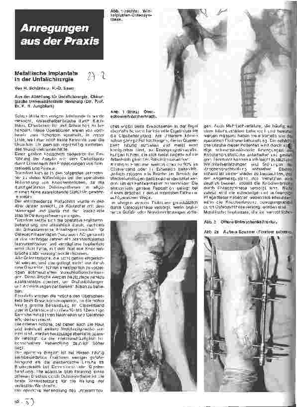 Vorschauseite 1: Metallische Implantate in der Unfallchirurgie