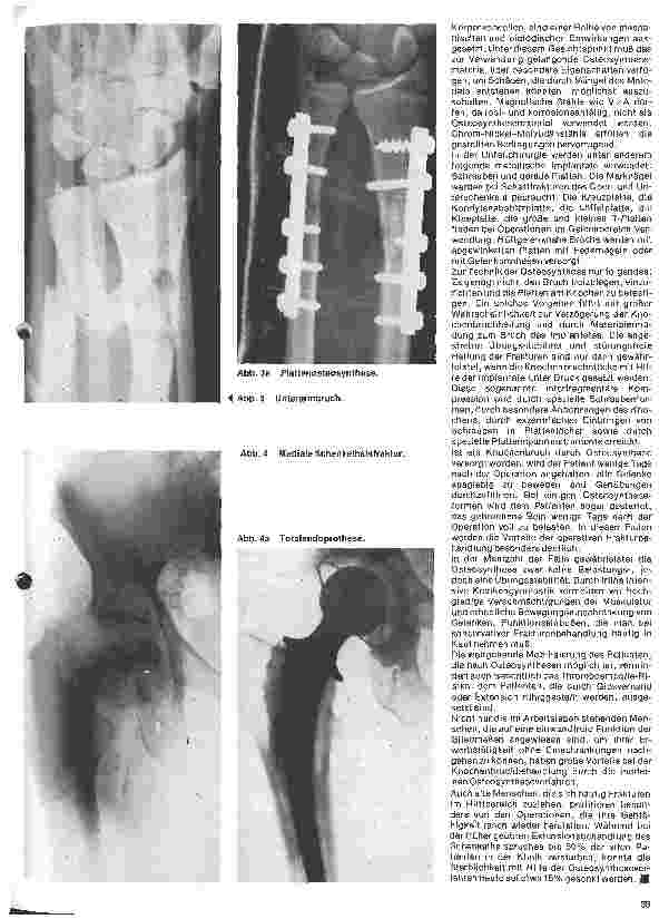 Vorschauseite 2: Metallische Implantate in der Unfallchirurgie