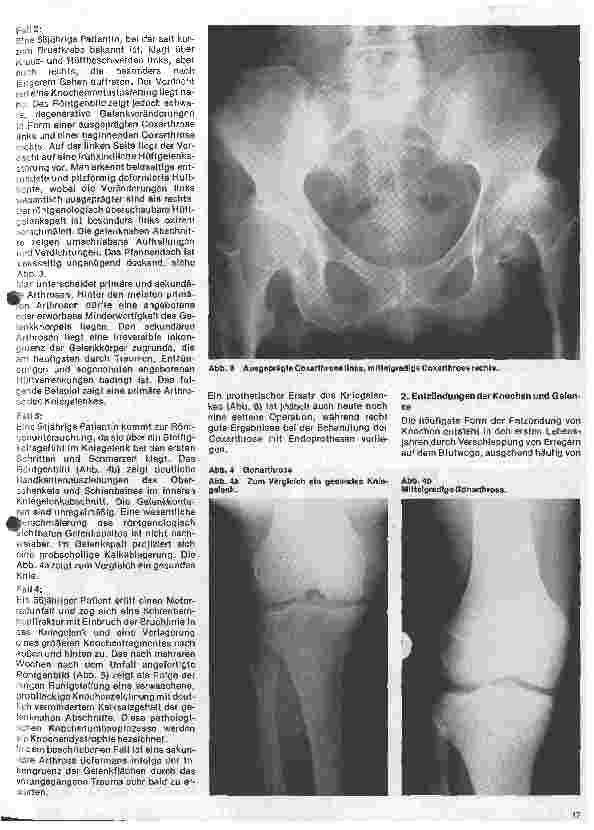 Vorschauseite 2: Radiologie Eine Einführung für Krankenschwestern und Pfleger 32. Folge: Röntgendiagnostik der Knochenu. Gelenkerkrankungen