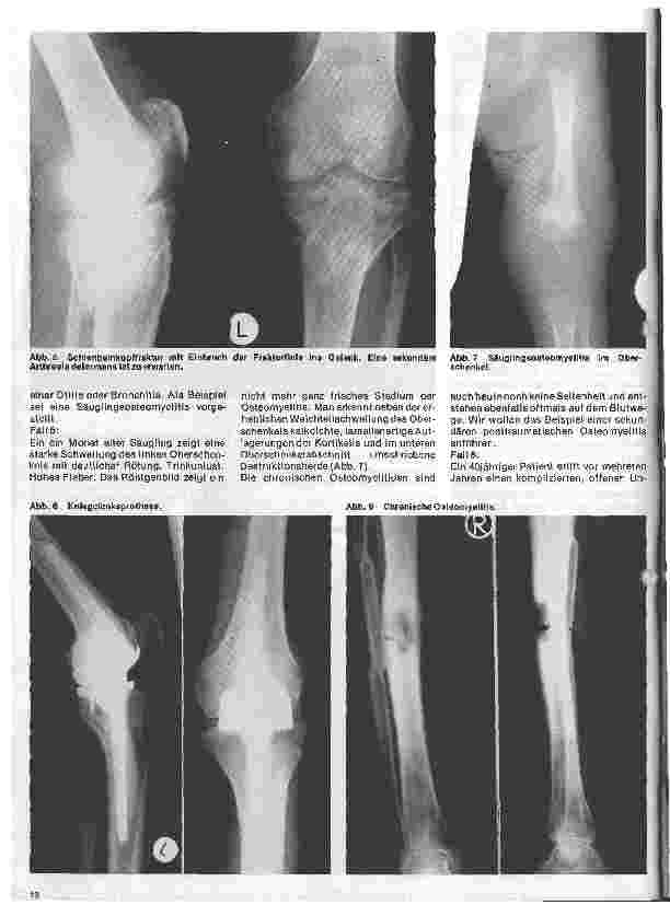 Vorschauseite 3: Radiologie Eine Einführung für Krankenschwestern und Pfleger 32. Folge: Röntgendiagnostik der Knochenu. Gelenkerkrankungen