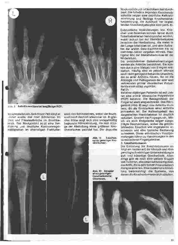 Vorschauseite 4: Radiologie Eine Einführung für Krankenschwestern und Pfleger 32. Folge: Röntgendiagnostik der Knochenu. Gelenkerkrankungen