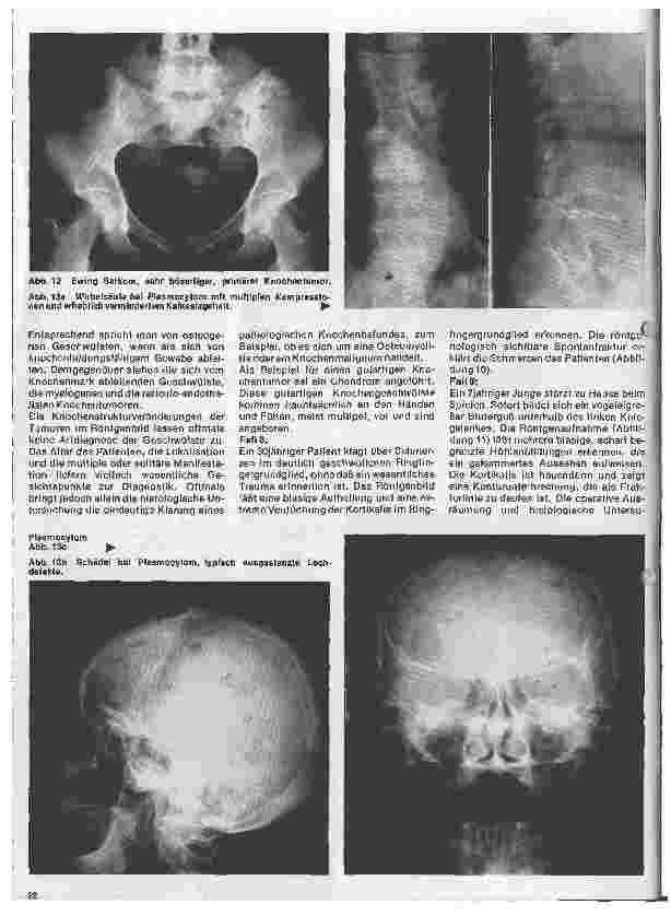 Vorschauseite 5: Radiologie Eine Einführung für Krankenschwestern und Pfleger 32. Folge: Röntgendiagnostik der Knochenu. Gelenkerkrankungen