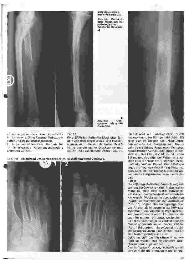 Vorschauseite 6: Radiologie Eine Einführung für Krankenschwestern und Pfleger 32. Folge: Röntgendiagnostik der Knochenu. Gelenkerkrankungen