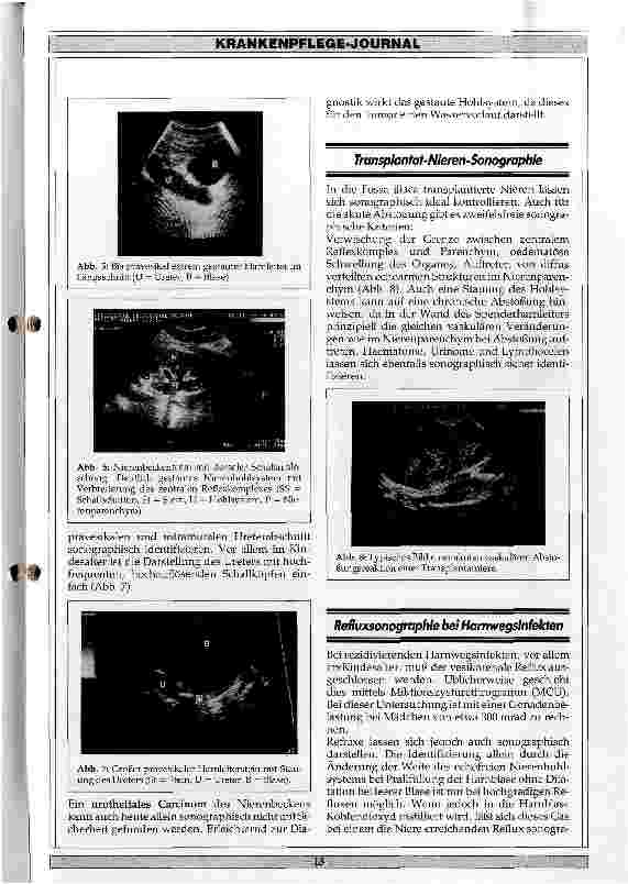 Vorschauseite 3: Ultraschall in der Urologie