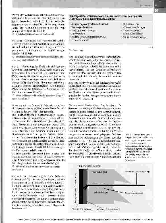 Vorschauseite 2: Kasuistik interaktivKomplikation nach lumbaler Bandscheibenoperation