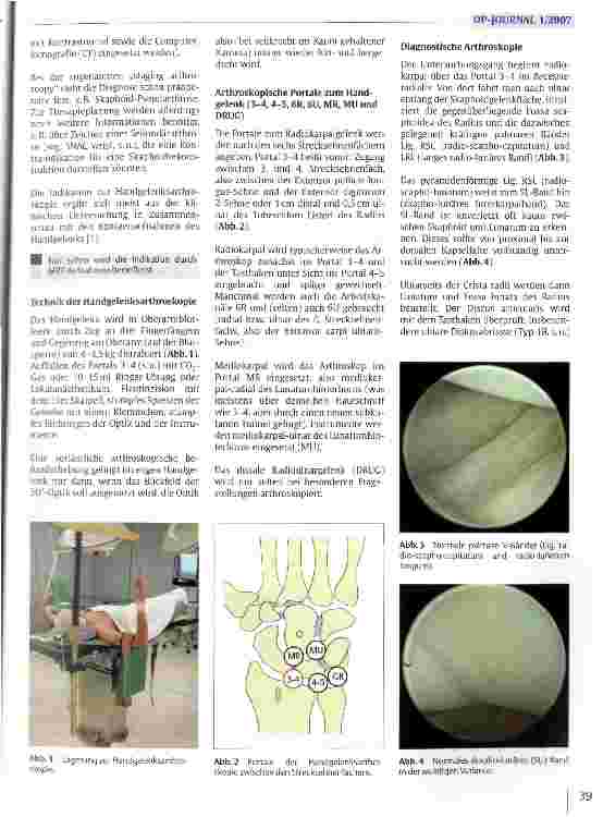 Vorschauseite 2: Arthroskopie des Handgelenks