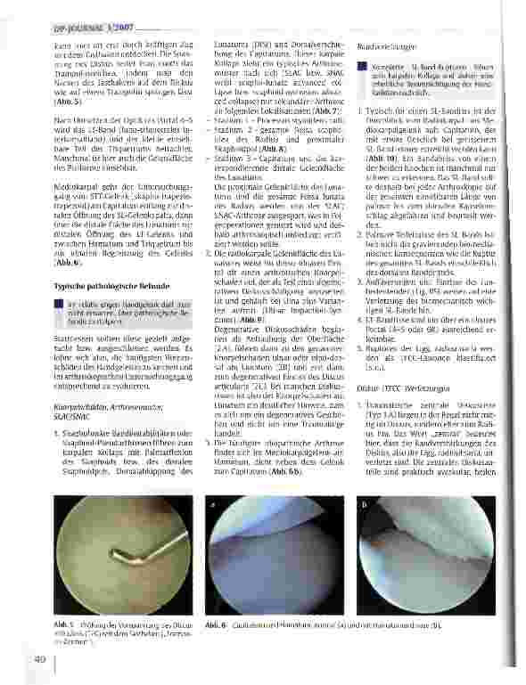 Vorschauseite 3: Arthroskopie des Handgelenks