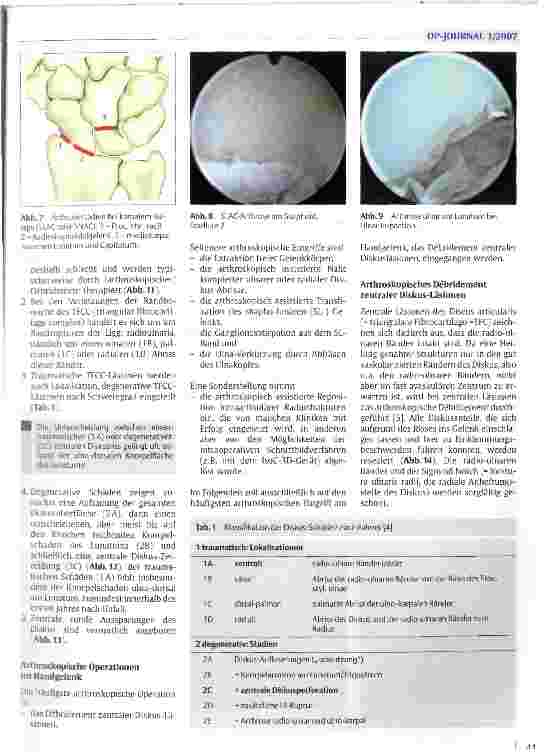 Vorschauseite 4: Arthroskopie des Handgelenks