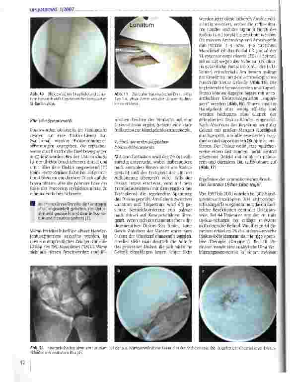 Vorschauseite 5: Arthroskopie des Handgelenks