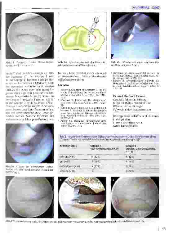 Vorschauseite 6: Arthroskopie des Handgelenks