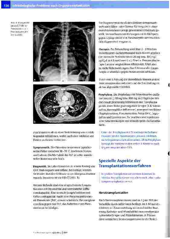 Vorschauseite 6: Infektiologische Probleme nach Organtransplantation