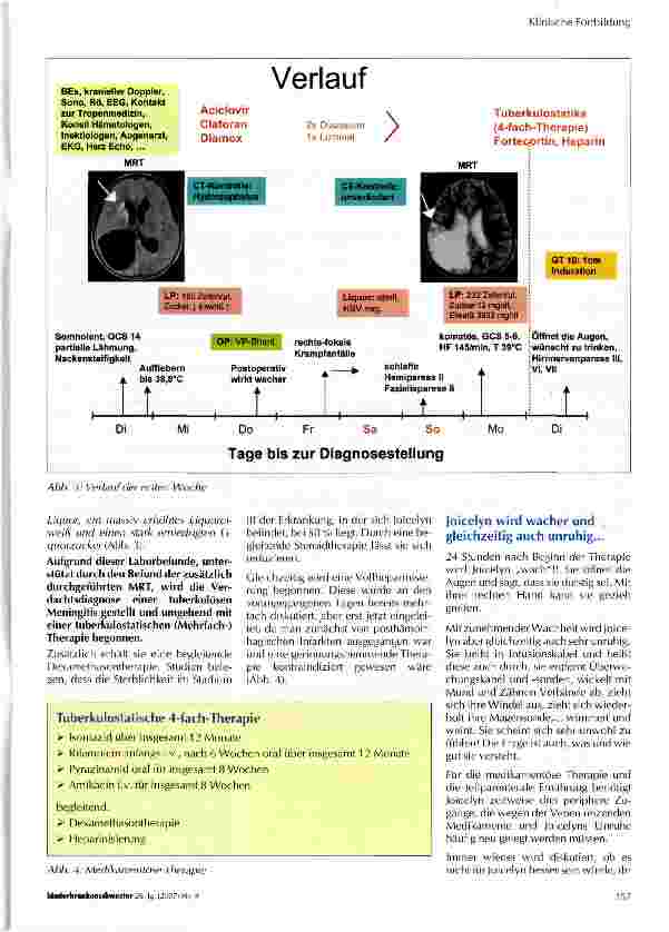 Vorschauseite 3: Joicelyn - ein Mädchen mit tuberkulöser Meningitis