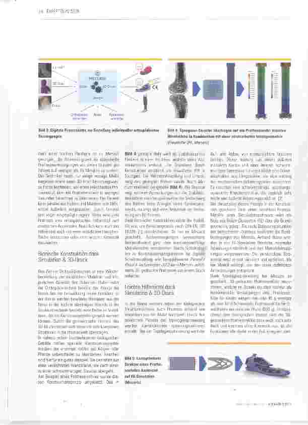 Vorschauseite 4: Im Einsatz: 3D-gedruckte Prothesen & Orthesen mit CE