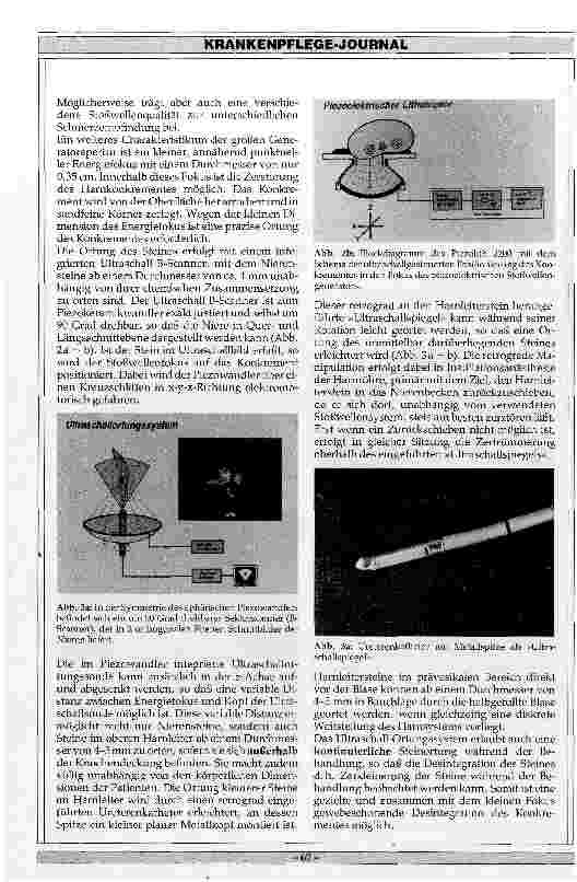 Vorschauseite 2: Extrakorporale Stoßwellenlithotripsie: Die extrakorporale piezioelektrische Stoßwellentherapie (EPL) mit dem Piezolith 2200