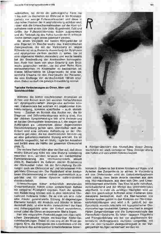 Vorschauseite 3: Zum diastrophischen Zwergwuchs