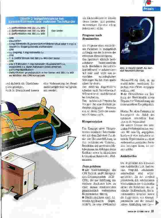 Vorschauseite 2: Kardiopulmonale Reanimation