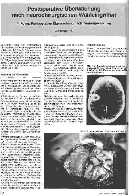 Vorschauseite 1: Postoperative Überwachung nach neurochirurgischen Wahleingriffen 4. Folge: Postoperative Überwachung nach Tumoroperationen