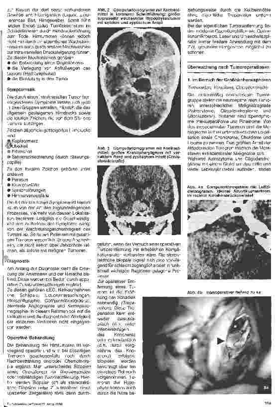 Vorschauseite 2: Postoperative Überwachung nach neurochirurgischen Wahleingriffen 4. Folge: Postoperative Überwachung nach Tumoroperationen