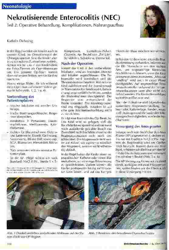 Vorschauseite 1: Nekrotisierende Enerocolitis (NEC), Teil 2 Operative Behandlung, Komplikationen, Nahrungsaufbau