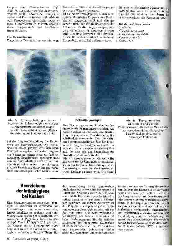 Vorschauseite 3: Behandlung des Pleuraempyems im Kindesalter